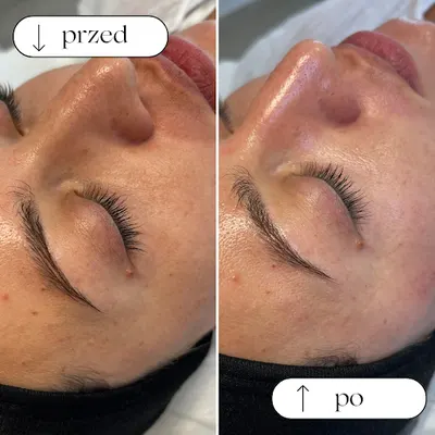 Gabinet Kosmetologii Skin Esthetics Nikola Świercz Kosmetologia